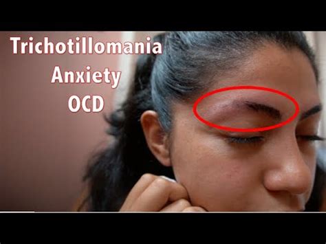 rubbing eyebrows anxiety|Grappling With Trichotillomania as the World Reopens .